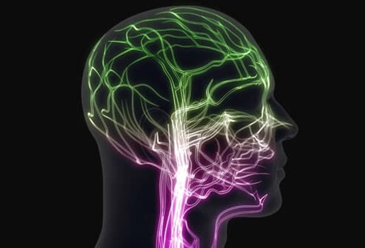 Migraine Symptoms Migraine Symptoms