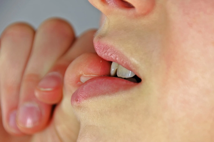 Possible Causes