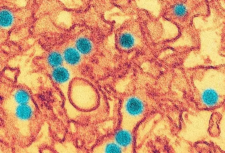 Zika Zika