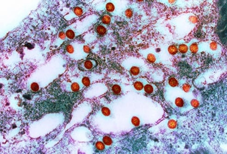 Rift Valley Fever Rift Valley Fever