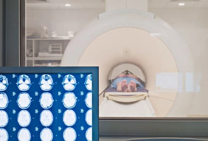 Diagnosing MS