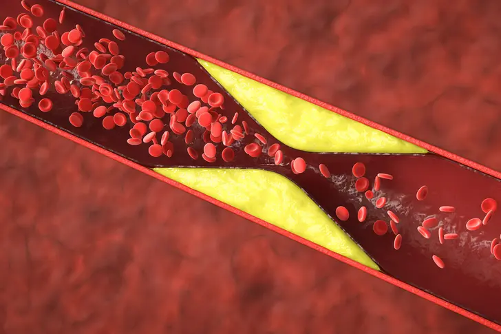 Your Cholesterol: Myths and Facts
