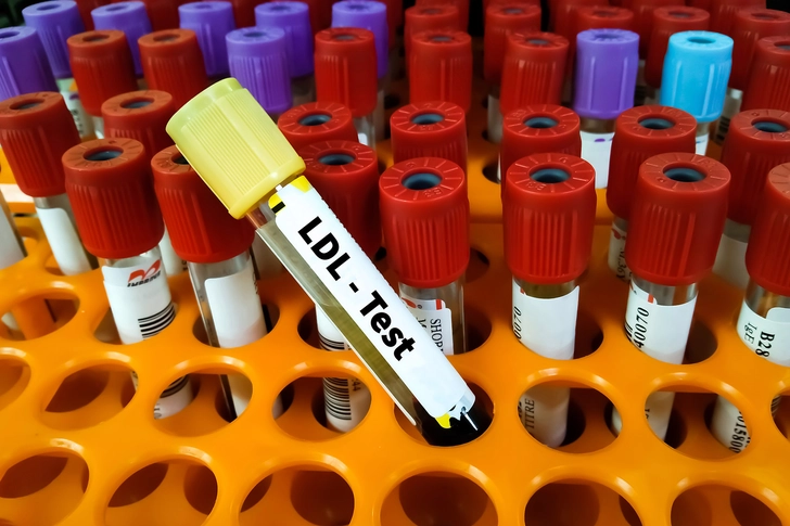Myth #9: High HDL Can Fix High LDL