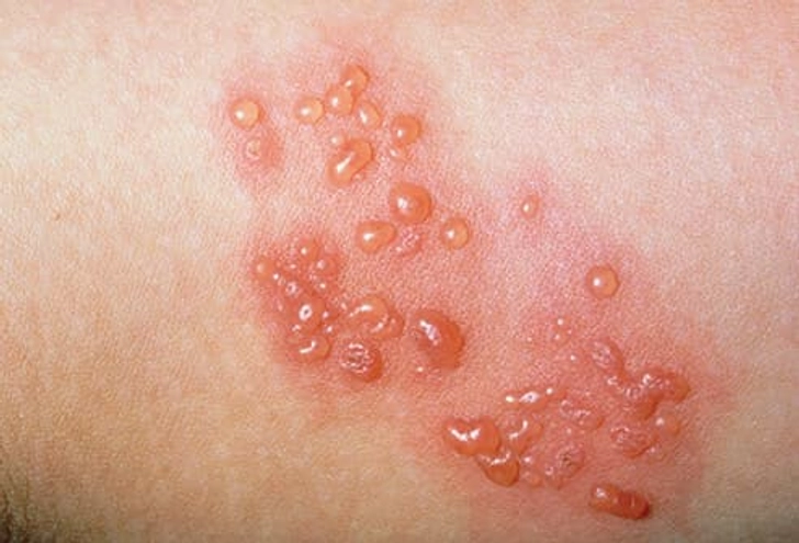 Myth: It’s Not Contagious