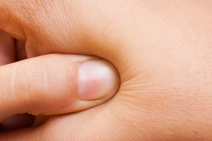 Acupressure Acupressure