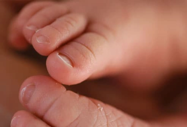 Baby Skin Is Sensitive Baby Skin Is Sensitive