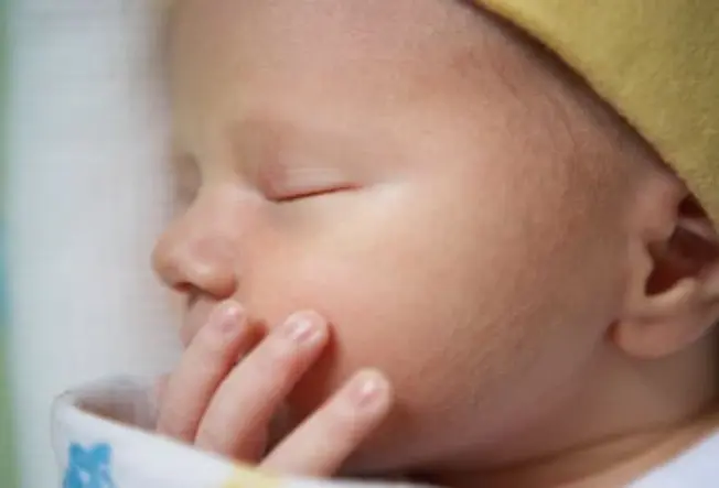 Healthy Baby Skin Healthy Baby Skin