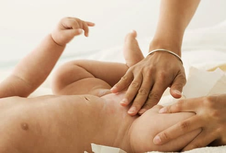 Diaper Rash