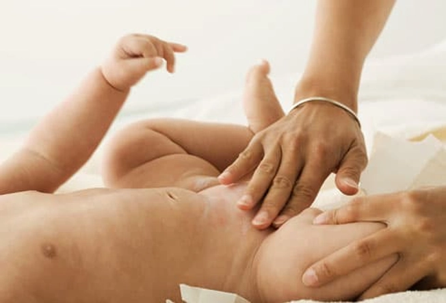 Diaper Rash Diaper Rash