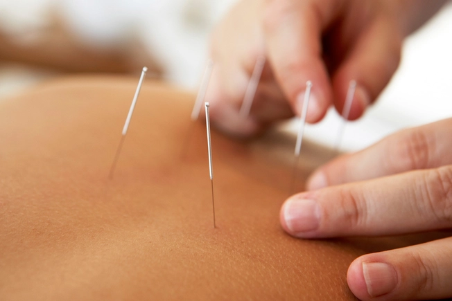 Reflexology and Acupuncture