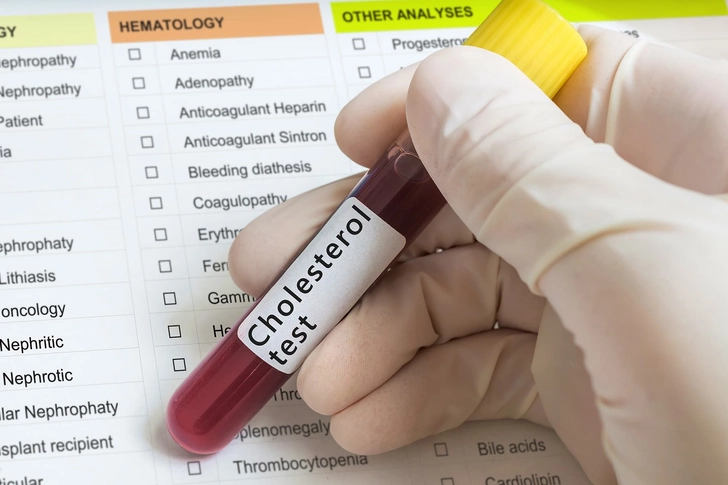 Lipid Profile Lipid Profile