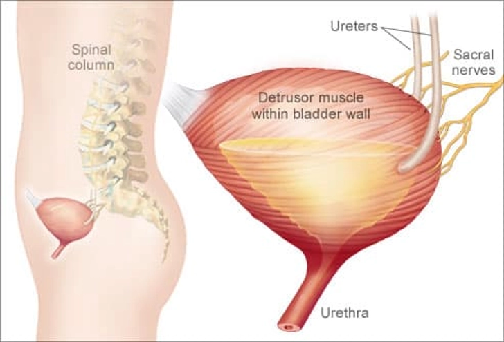 How the Bladder Gets Confused