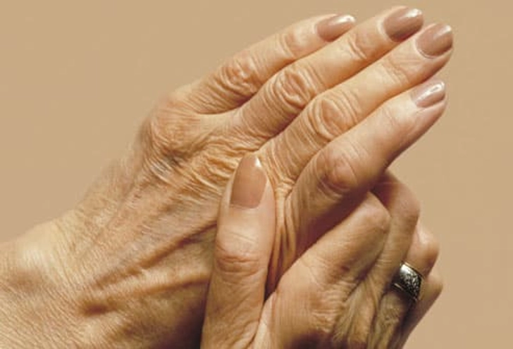 Useful for Rheumatoid Arthritis
