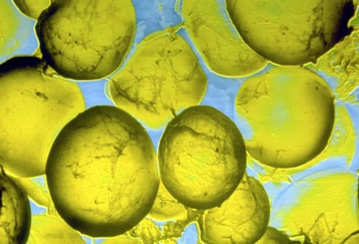 Cutting Triglycerides