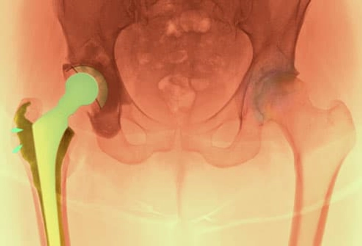 Is Surgery for You? Is Surgery for You?