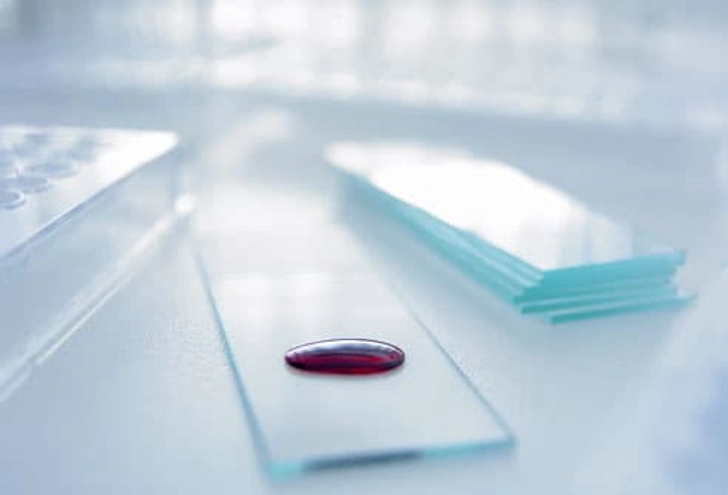 Ovarian Cancer Screening Tests