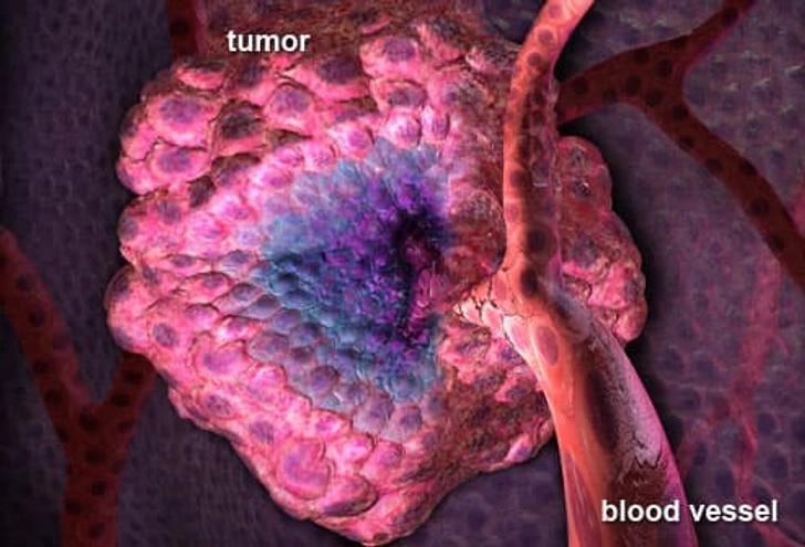 Targeted Therapies
