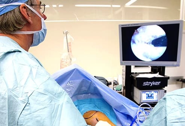 Arthroscopy Arthroscopy