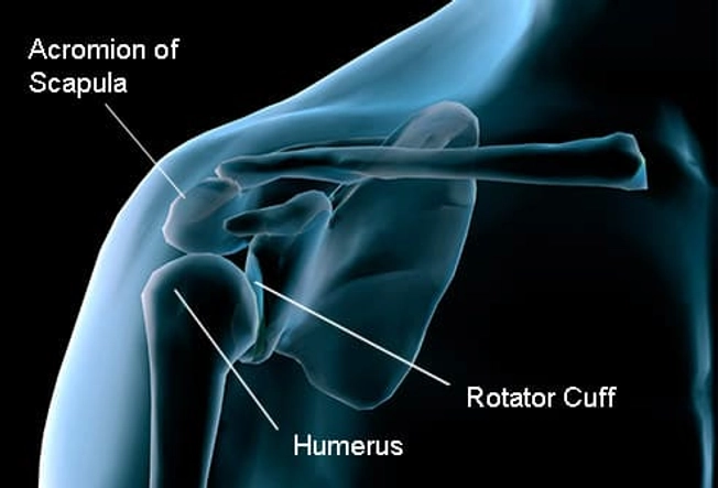 Shoulder Parts