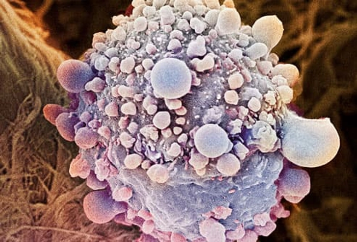 Targeted Therapy Targeted Therapy