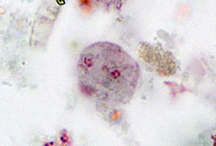 D. Fragilis D. Fragilis