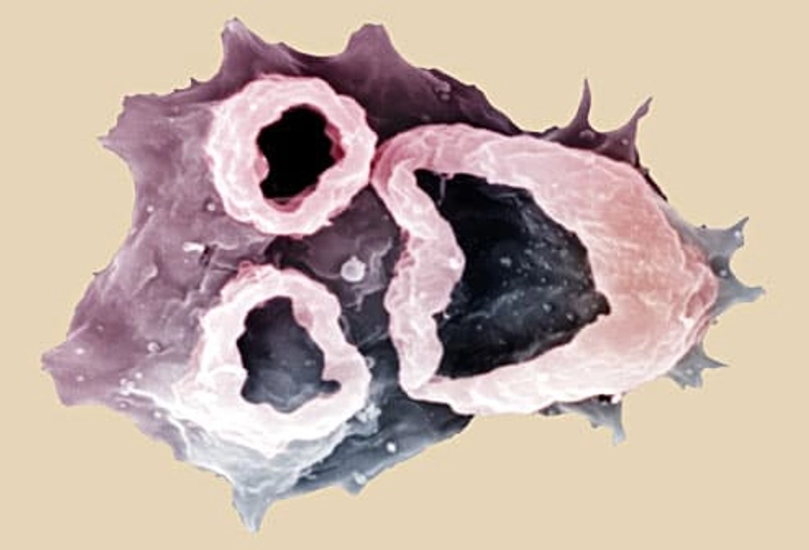 Brain-Eating Amoeba Brain-Eating Amoeba
