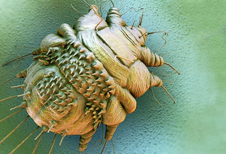 Scabies Scabies