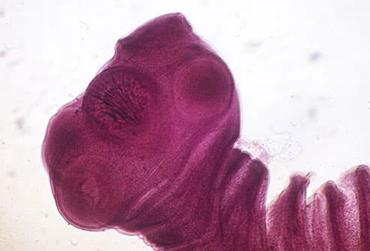 Pork Tapeworms Pork Tapeworms