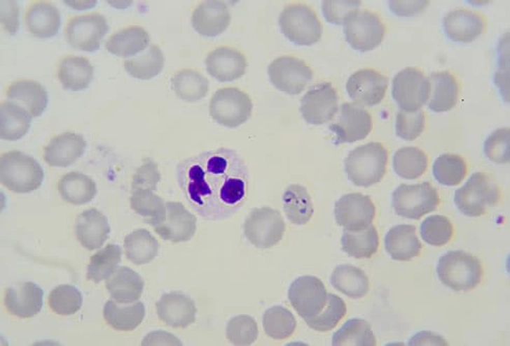 P. Falciparum P. Falciparum