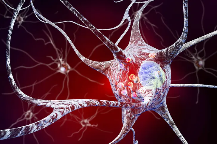 What Is Parkinson’s Disease?