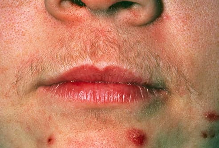 Other Symptoms