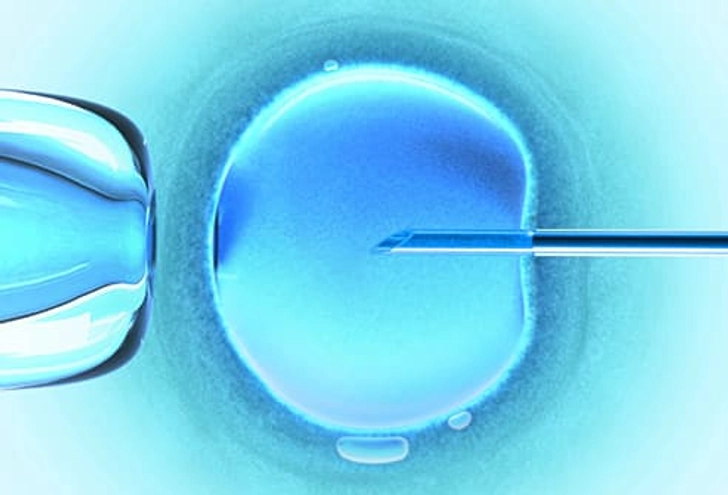 Infertility Treatment Infertility Treatment