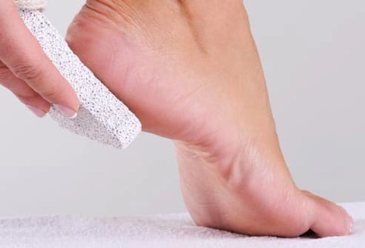 Do Soften Calluses Carefully Do Soften Calluses Carefully