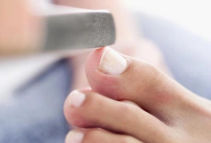 Do Trim Toenails Right Do Trim Toenails Right