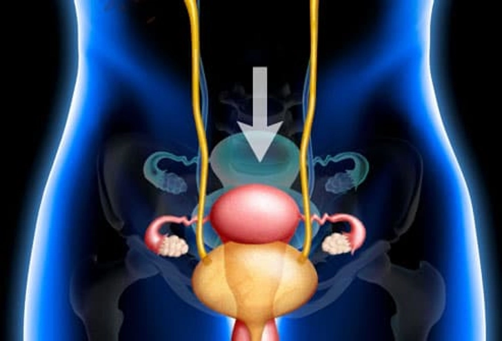 Pelvic Organ Prolapse