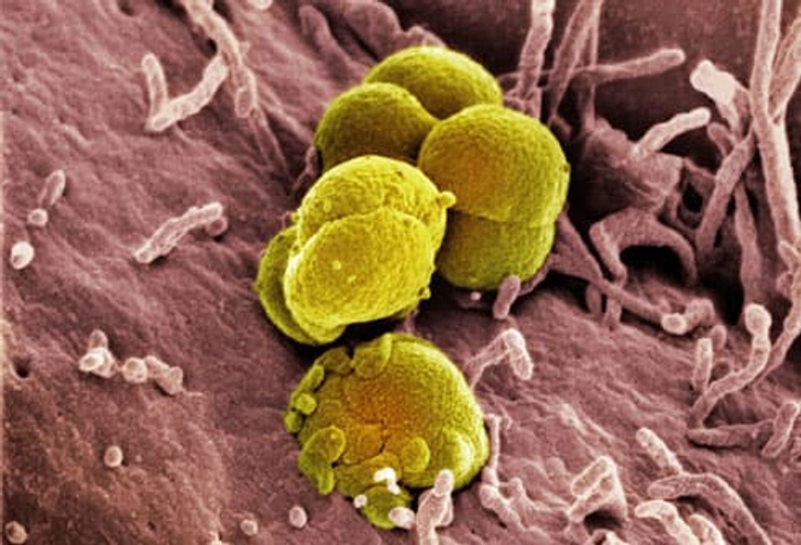 Sexually Transmitted Diseases