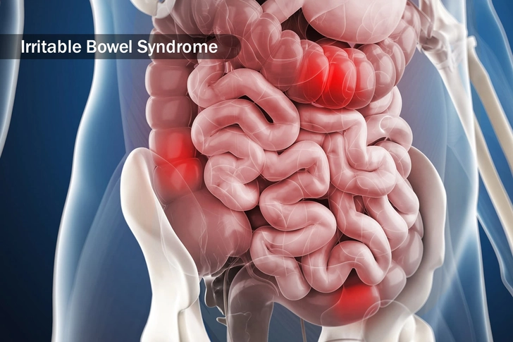 Upset Stomach Upset Stomach