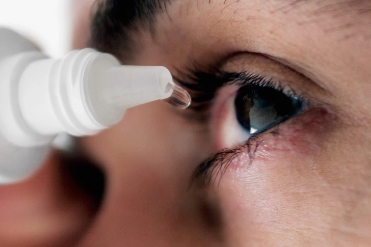 Treating Pinkeye Treating Pinkeye