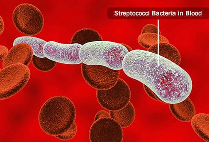 Complication: Bacteremia