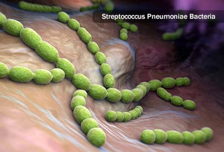 Cause: Bacteria