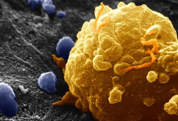 A Primer on Skin Cancer