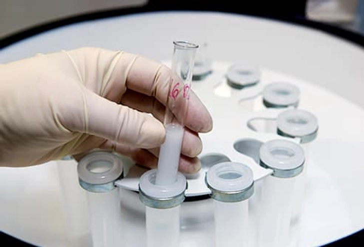 Reason: In Vitro Fertilization