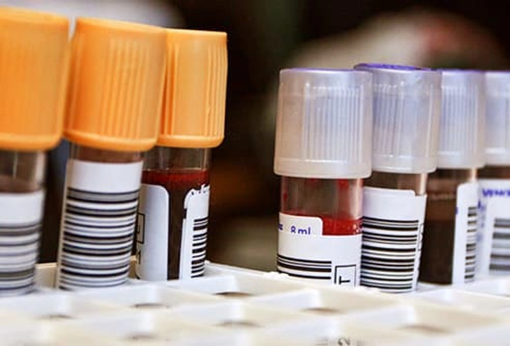 Genetic Counseling