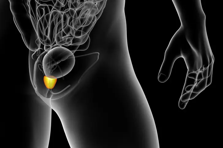 Prostate Cancer Survival