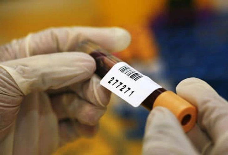 PSA Test Results