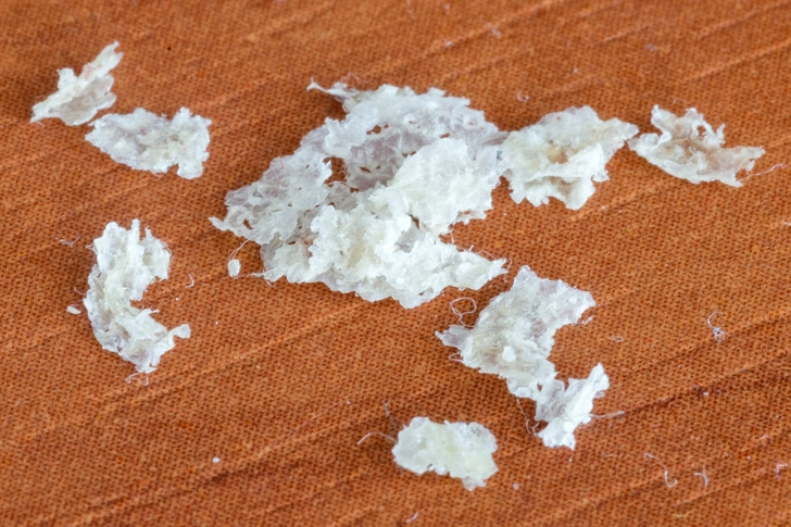 Flaking Skin Flaking Skin