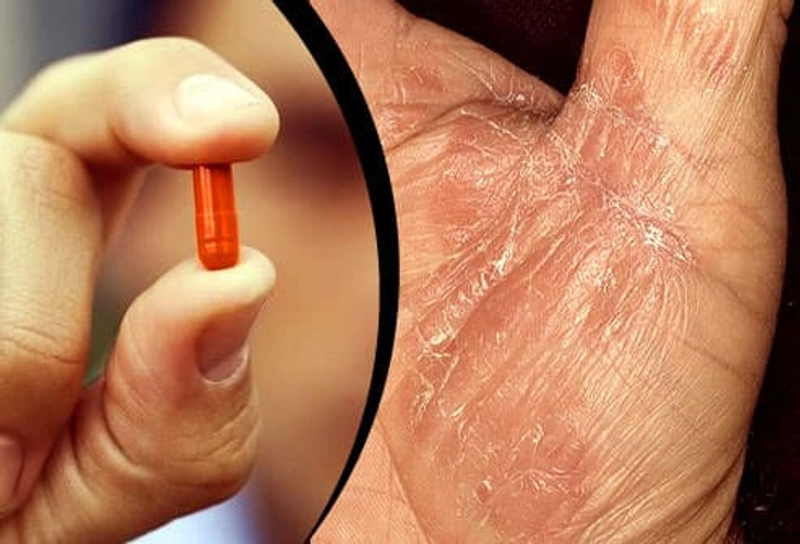 Medications Medications
