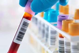 When Will You Do a Biomarker Test?