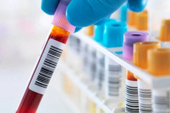When Will You Do a Biomarker Test? When Will You Do a Biomarker Test?
