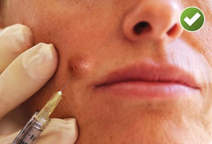 DO: Try Corticosteroid Injections